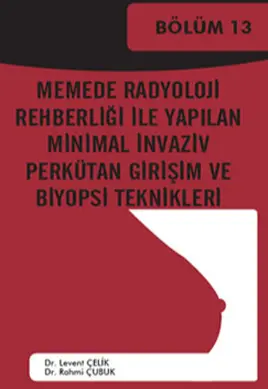 Memede Radyoloji Rehberliği ile yapılan minimal invaziv perkütan girişim ve biyopsi teknikleri