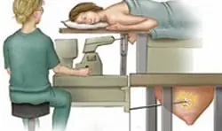 Sterotaksik vakum biyopsi nedir ?